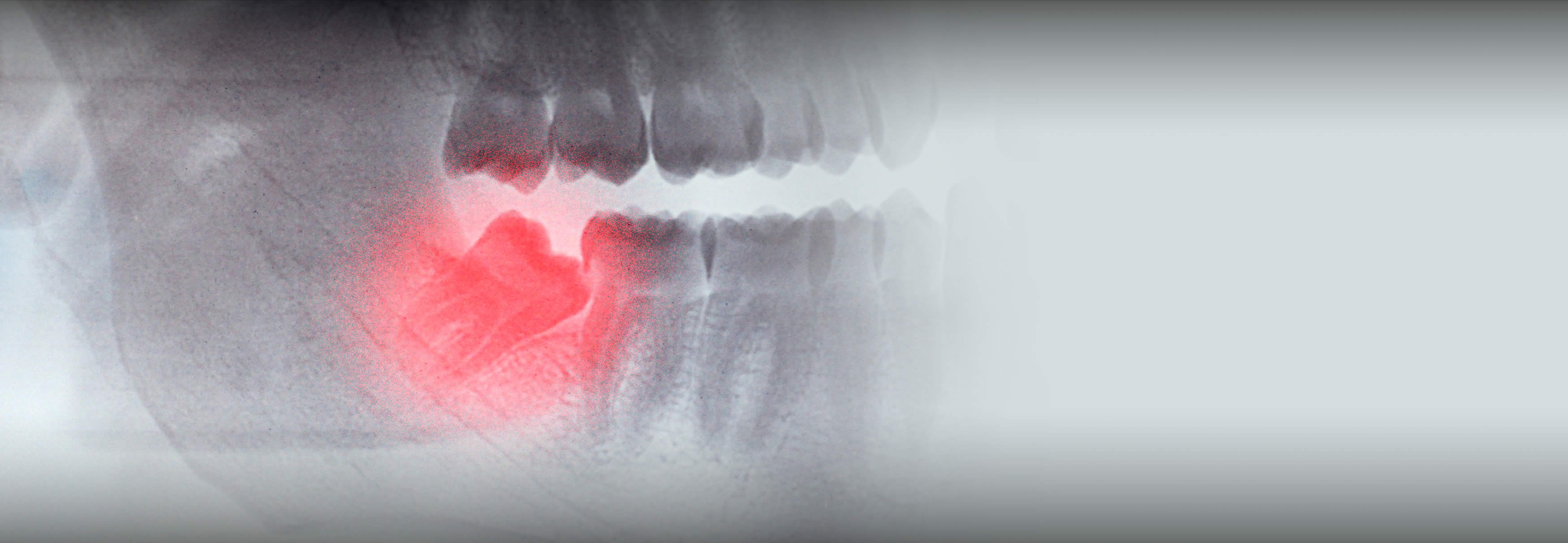 Oral Surgery London